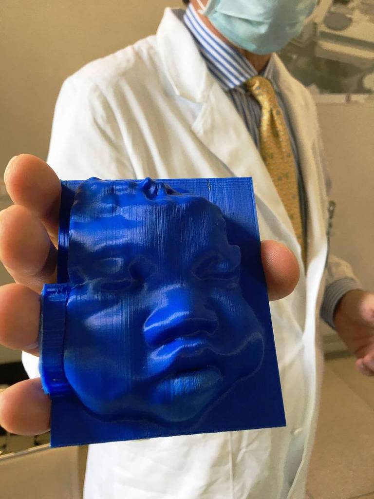 SALUTE: ecografia, il volto del feto in 3D